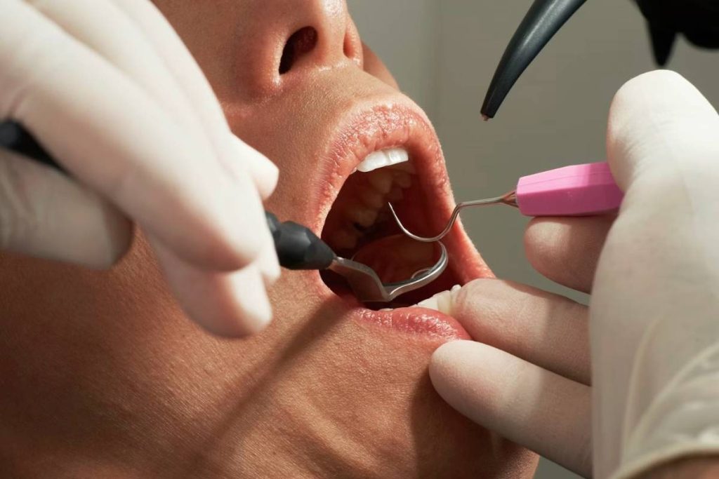 free-dentures-for-low-income-adults