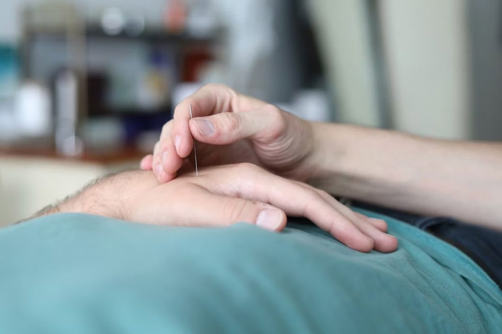 does-medicaid-cover-acupuncture