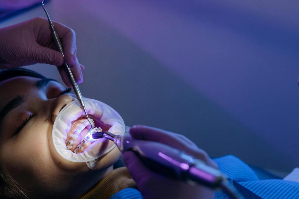 How-to-get-free-braces-with-Medicaid-in-Texas-