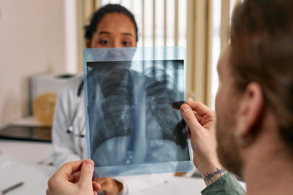 does-medicaid-cover-tb-test