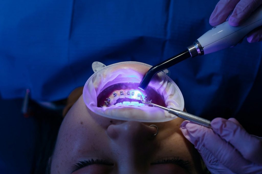 does medicaid cover braces in florida
