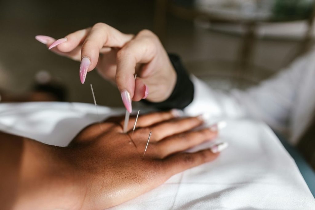 does medicare cover acupuncture
