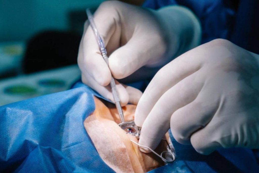 does-medicare-cover-cataract-surgery