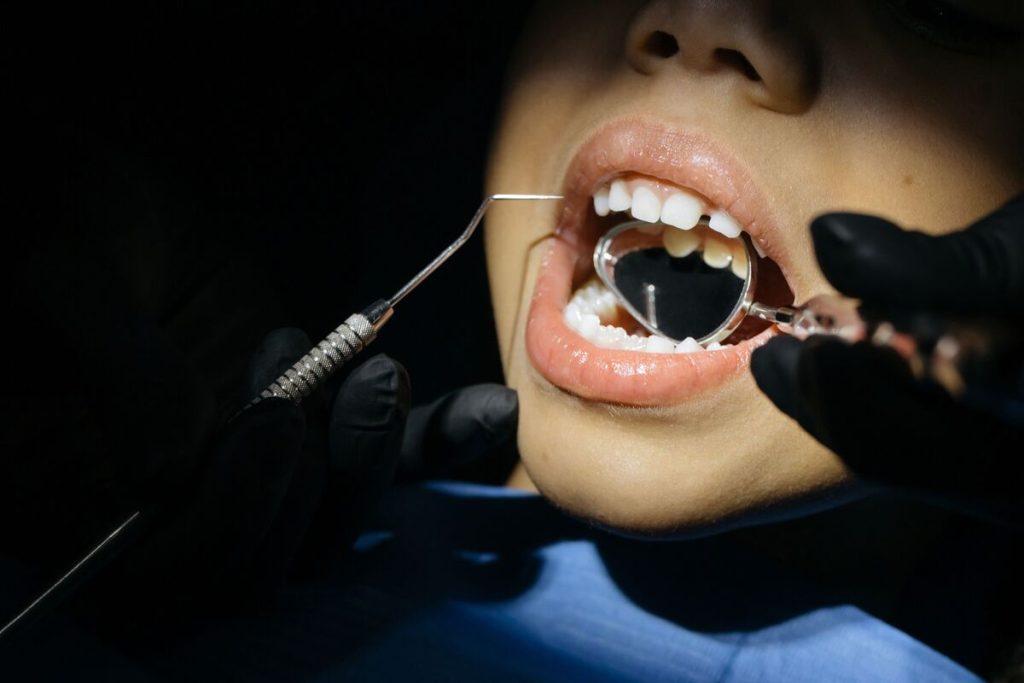 how-much-are-braces-for-kids